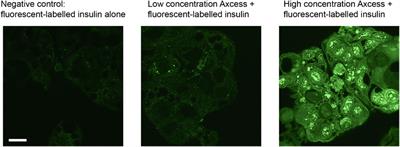 Glucagon-like peptide-1 receptor agonists for treatment of diabetes and obesity: advantage of oral delivery